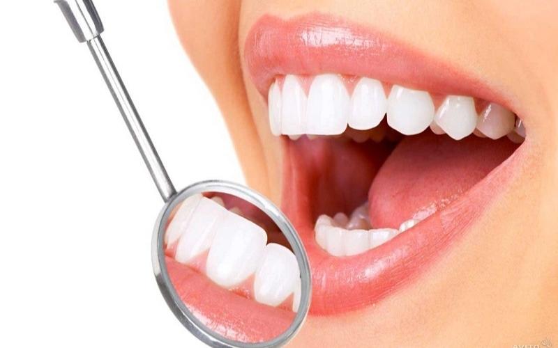 Các loại răng sứ dùng để bọc phổ biến hiện nay