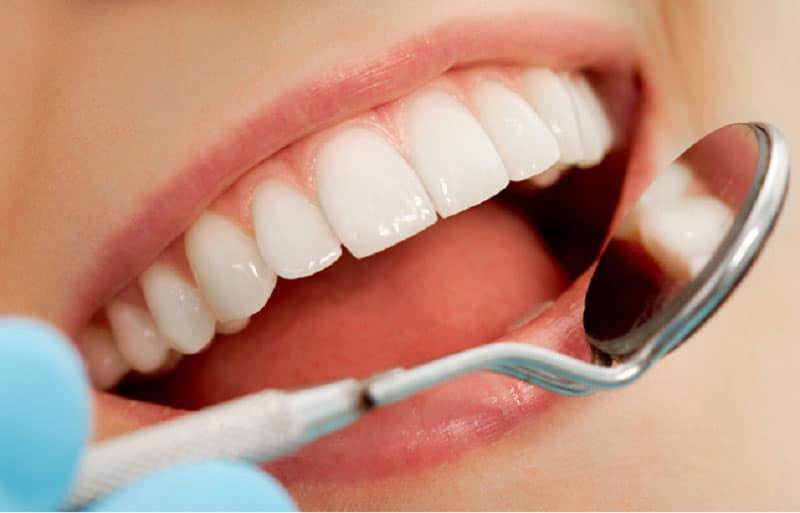 Những ưu điểm khi bọc răng sứ
