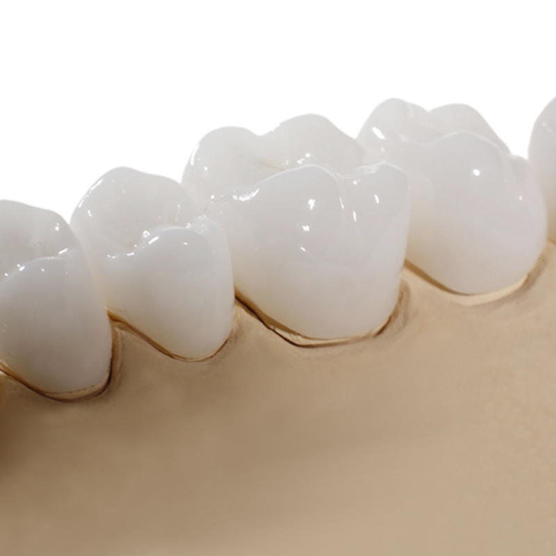 5 loại răng sứ tốt nhất tại Nha Khoa Phúc Gia